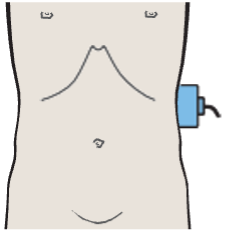 Adrenal gland, kidney, spleen