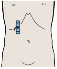 Layers of adrenal gland