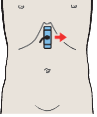 Cardia, liver