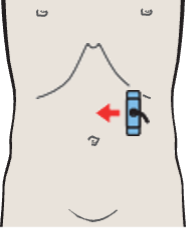 Body of stomach, liver