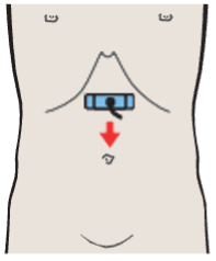 Left gastric artery