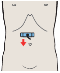Antrum, duodenum, liver, pancreas, gallbladder