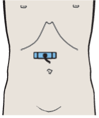 Antrum, gallbladder
