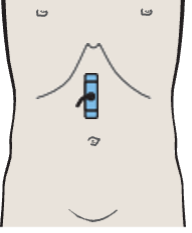 Layers of gastric wall