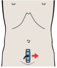 Bladder, ureteral orifice, prostate, rectum