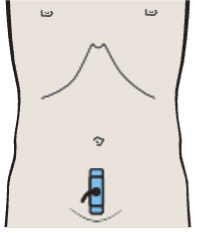 Bladder, bowel