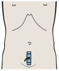 Bladder, inflow of urine