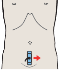 Prostate, rectum, bladder