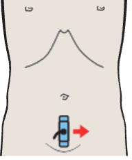 Prostate, seminal vesicles