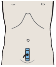 Prostate, seminal vesicles