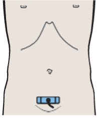 Seminal vesicles, bladder