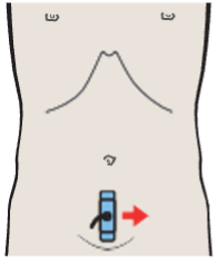 Vagina, uterus, bladder