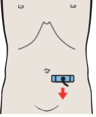 Left iliac vessels