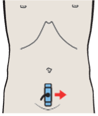 Uterus, bladder