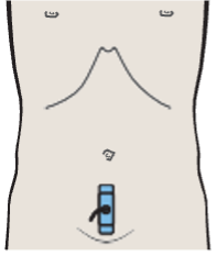 Bladder, ovary