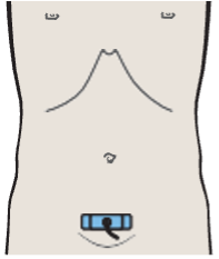 Uterus, bladder, rectum, ovaries