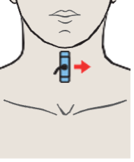 Left lobe of thyroid gland, sternohyoid muscle, sternothyroid muscle, internal jugular vein