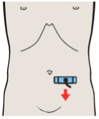 Left iliac vessels