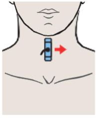 Left lobe of thyroid gland, sternocleidomastoid muscle, common carotid artery, internal jugular vein