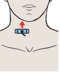 Right lobe of thyroid gland, sternocleidomastoid muscle, common carotid artery, internal jugular vein