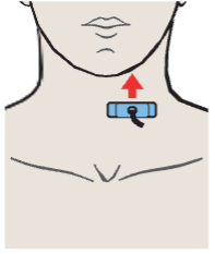 Left lobe of thyroid gland, sternocleidomastoid muscle, omohyoid muscle, common carotid artery, internal jugular vein
