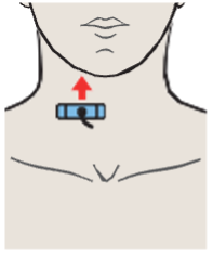 Right lobe of thyroid gland, sternocleidomastoid muscle, omohyoid muscle, sternohyoid muscle, common carotid artery, internal jugular vein
