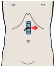 Splenic vein and left gastric artery