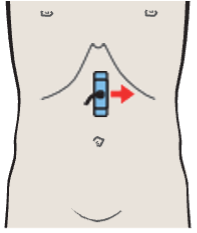 Splenic artery and vein, celiac trunk