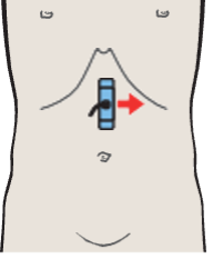 Splenic artery and vein, renal artery and vein