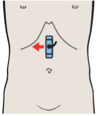 Hepatic artery and splenic vein