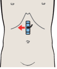 Hepatic artery and superior mesenteric vein