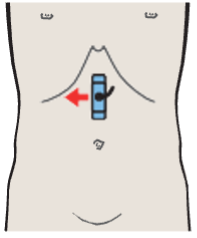 Hepatic artery and portal vein