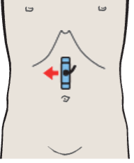 Aorta