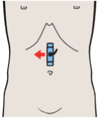 Right renal artery and right renal vein