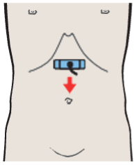 Celiac trunk