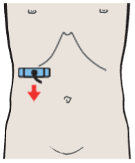 Renal vein