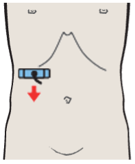 Renal artery