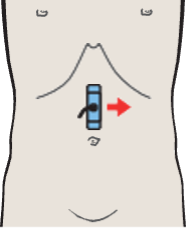Vena cava