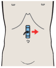 Left renal vessels, splenic artery and vein