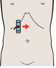 Portal vein, vena cava, right renal artery