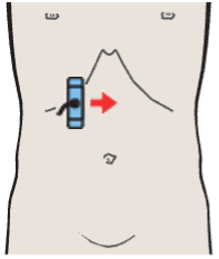 Portal vein, vena cava, right renal artery, and bile duct