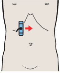 Portal vein and hepatic artery