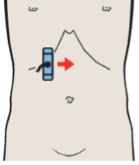 Hepatic artery, superior mesenteric artery, and splenic vein