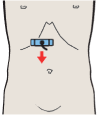 Bile duct, gallbladder, superior mesenteric vein