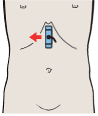 Left lobe of liver, ligamentum teres, boundary between lateral and medial segments, caudate lobe