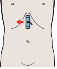 Left hepatic vein, ligamentum teres, boundary between lateral and medial segments, caudate lobe