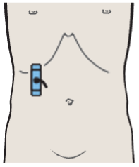 Posterior segment, lateral portions of liver, kidney