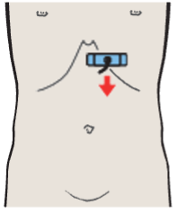 Left lobe of liver, lateral segment, heart