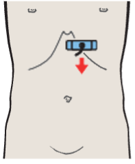 Left lobe of liver, lateral segment, caudate lobe