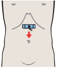 Superior mesenteric artery